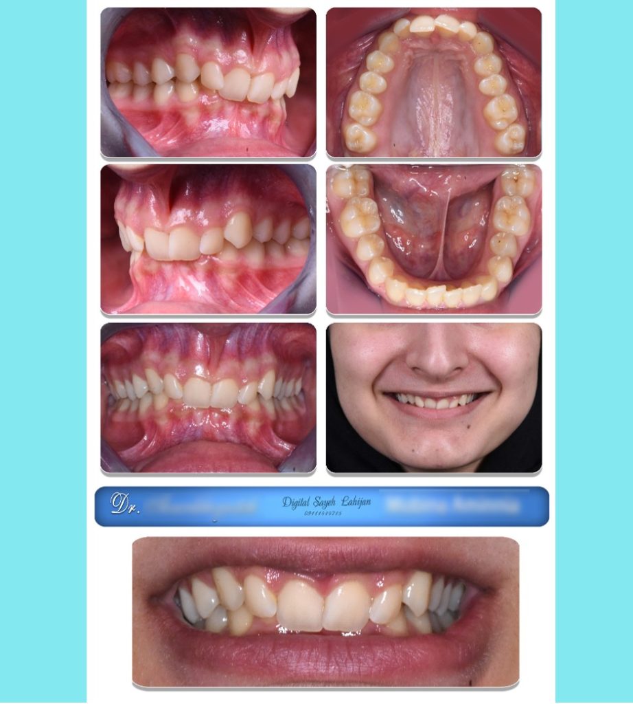 عکاسی پزشکی سایه در لاهیجان